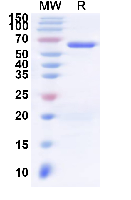 SDS-PAGE for Recombinant Human VPS72 Protein, N-His-KSI