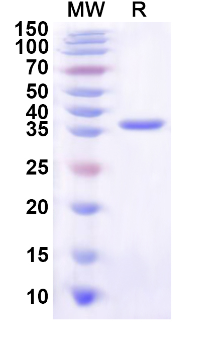SDS-PAGE for Recombinant Human WDR82 Protein, N-His
