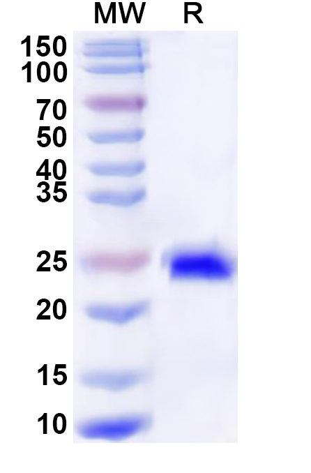 SDS-PAGE for Recombinant Human XPA Protein, N-His