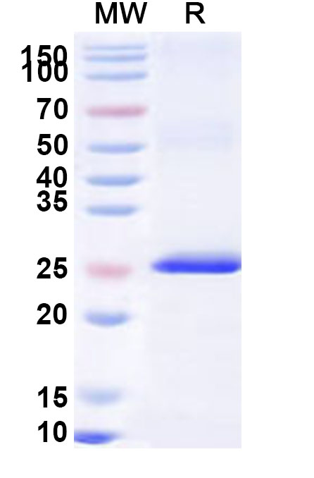 SDS-PAGE for Recombinant Human XPO4 Protein, N-His