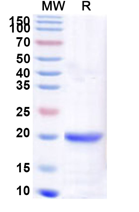 SDS-PAGE for Recombinant Human ZBED1 Protein, N-His