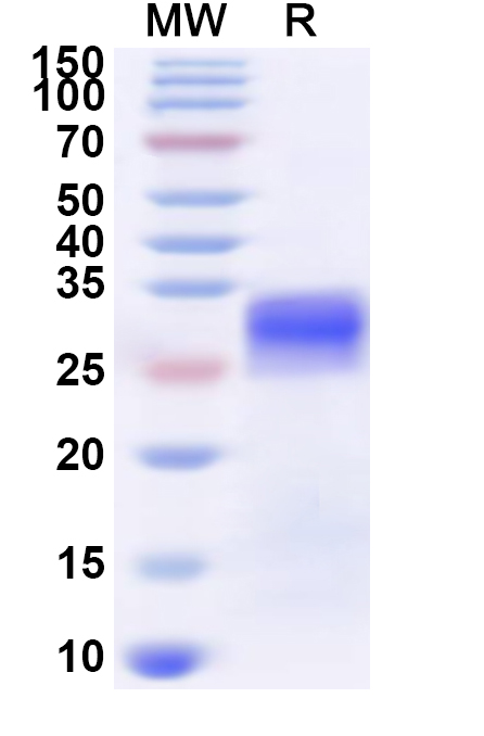 SDS-PAGE for Recombinant Human ZFP1 Protein, N-His