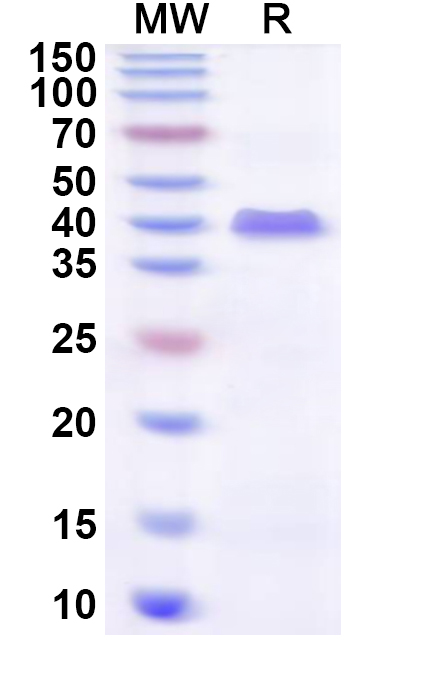 SDS-PAGE for Recombinant Human ZFP2 Protein, N-His