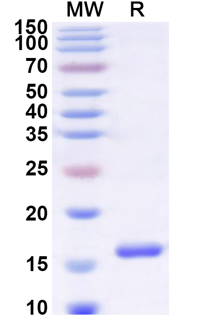 SDS-PAGE for Recombinant Human ZFYVE16 Protein, N-His
