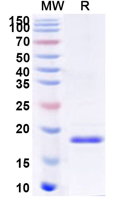 SDS-PAGE for Recombinant Human ZG16 Protein, N-His