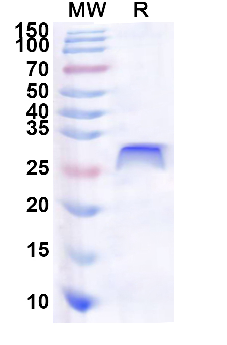 SDS-PAGE for Recombinant Human ZKSCAN8 Protein, N-His