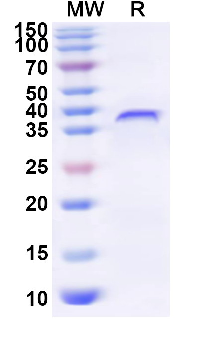 SDS-PAGE for Recombinant Human ZNF140 Protein, N-His