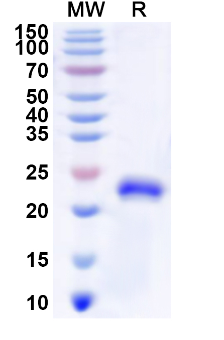SDS-PAGE for Recombinant Human ZNF165 Protein, N-His