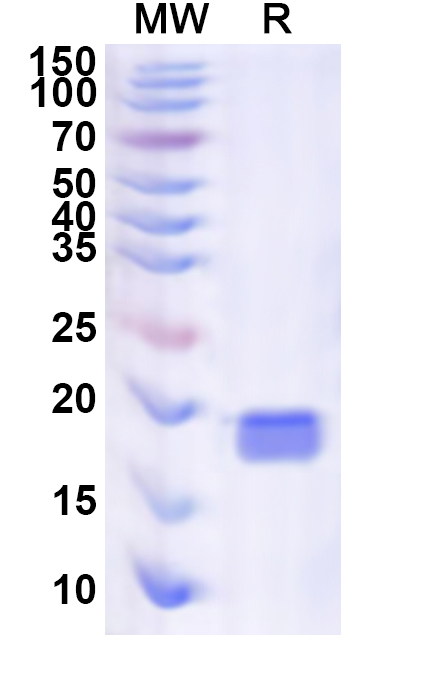 SDS-PAGE for Recombinant Human ZNF18 Protein, N-His