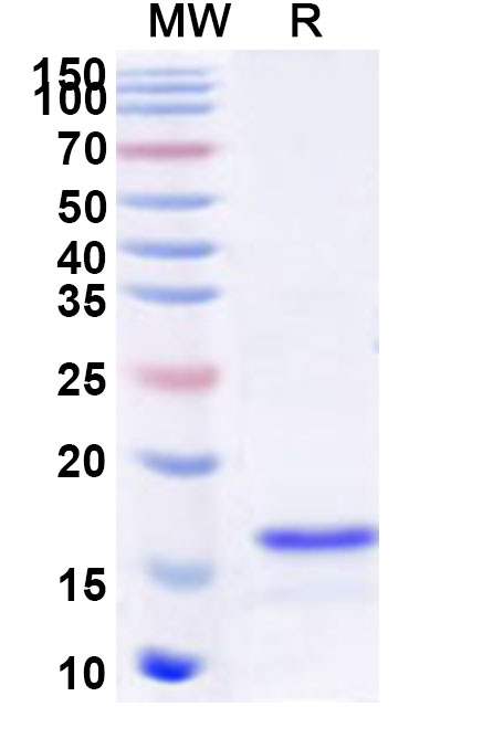 SDS-PAGE for Recombinant Human ZNF217 Protein, N-His