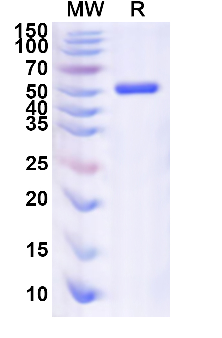 SDS-PAGE for Recombinant Human ZNF24 Protein, N-His
