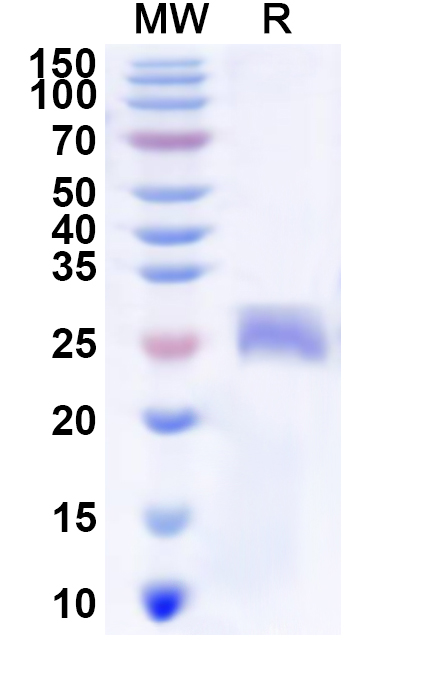 SDS-PAGE for Recombinant Human ZNF3 Protein, N-His