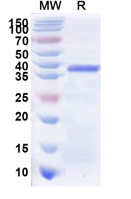 SDS-PAGE for Recombinant Human ZNF322 Protein, N-His