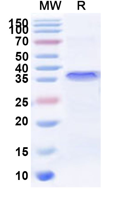 SDS-PAGE for Recombinant Human ZNF449 Protein, N-His