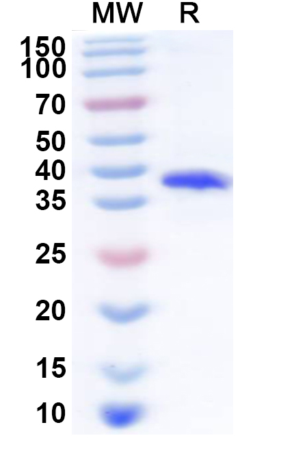 SDS-PAGE for Recombinant Human ZNF460 Protein, N-His