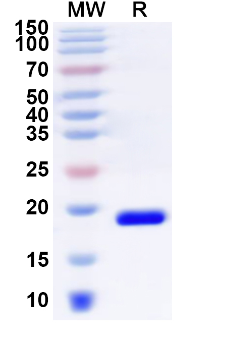 SDS-PAGE for Recombinant Human ZNF746 Protein, N-His