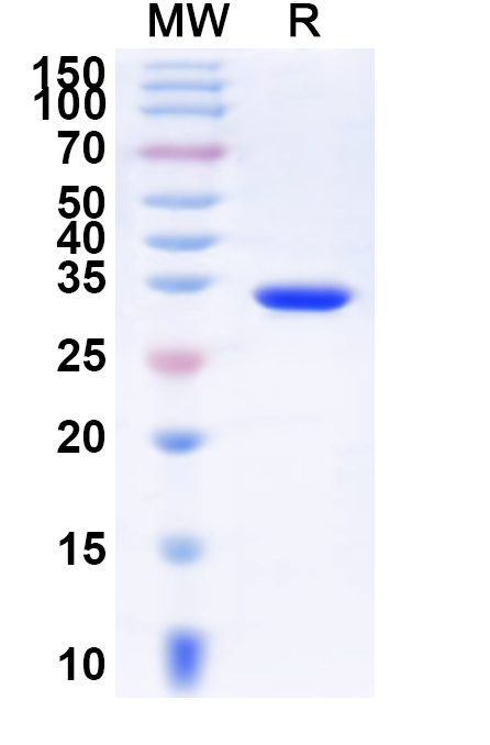 SDS-PAGE for Recombinant Human ZNF750 Protein, N-His-KSI