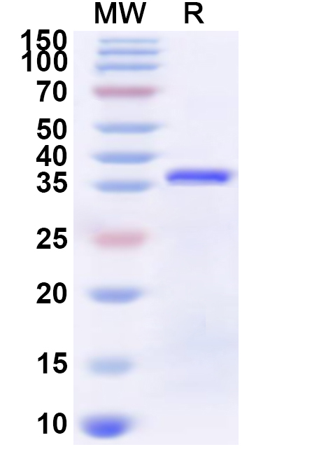 SDS-PAGE for Recombinant Human ZNF774 Protein, N-His