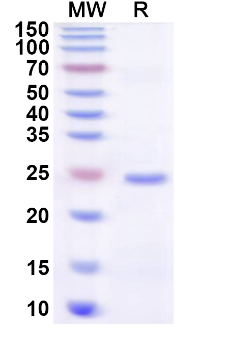 SDS-PAGE for Recombinant Human ZNF783 Protein, N-His