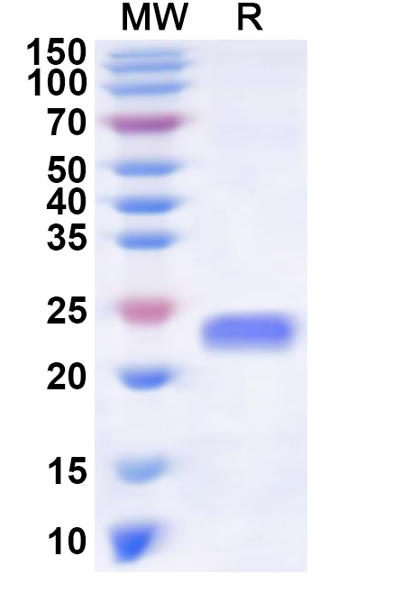 SDS-PAGE for Recombinant Human ZSCAN23 Protein, N-His