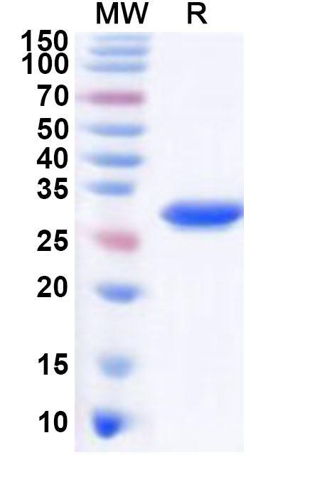 SDS-PAGE for Recombinant IBV 3CL Protein, N-His