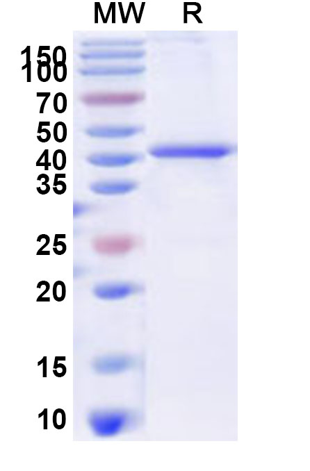 SDS-PAGE for Recombinant IBV nsp3 Protein, N-His