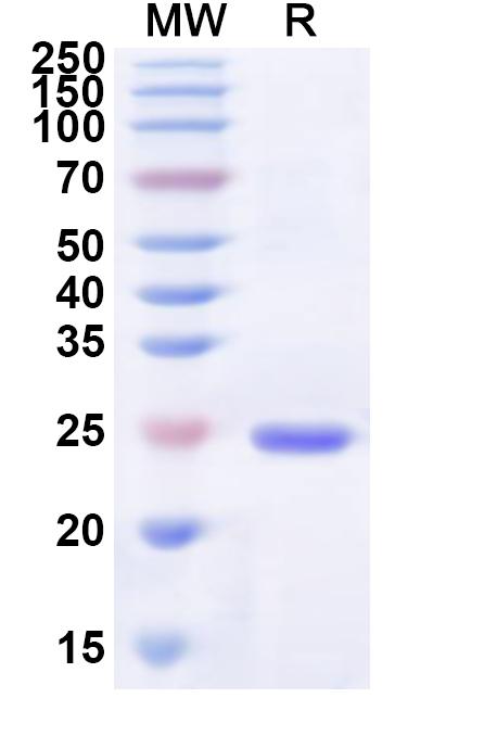 SDS-PAGE for Recombinant IBV S1-NTD Protein, N-His