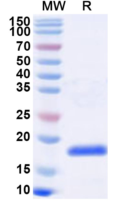 SDS-PAGE for Recombinant Influenza A virus (H10N7) Matrix protein 1 Protein, N-His