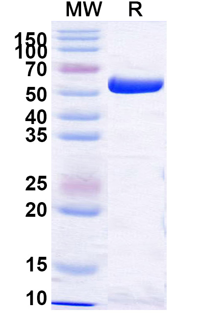SDS-PAGE for Recombinant Influenza A virus NP/Nucleoprotein, N-His