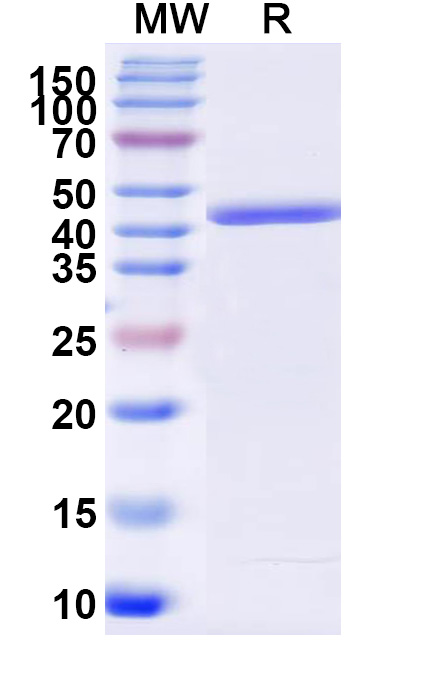 SDS-PAGE for Recombinant JEV Envelope protein E Protein, N-His