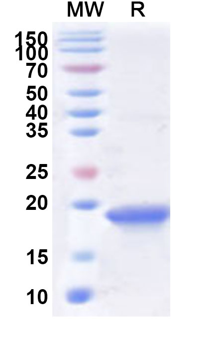 SDS-PAGE for Recombinant LSDV Fusion Protein/LSDV117 Protein, N-His