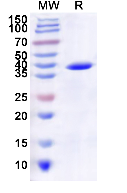 SDS-PAGE for Recombinant LSDV G-protein-coupled chemokine like receptor/LSDV011 Protein, N-GST & C-His