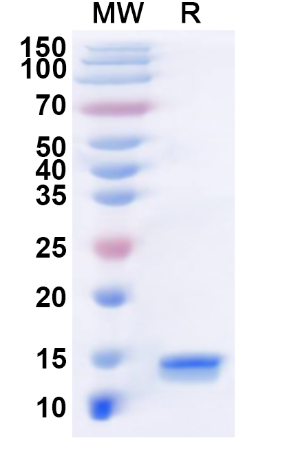 SDS-PAGE for Recombinant LSDV P32/Envelope protein/LSDV074 Protein, N-His
