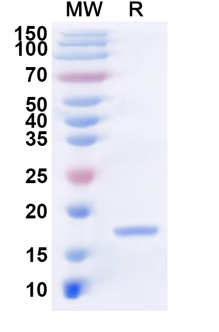 SDS-PAGE for Recombinant LSDV RPO30/LSDV035 Protein, N-His
