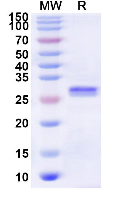 SDS-PAGE for Recombinant Mite Blo t 1.0101 Protein, N-His