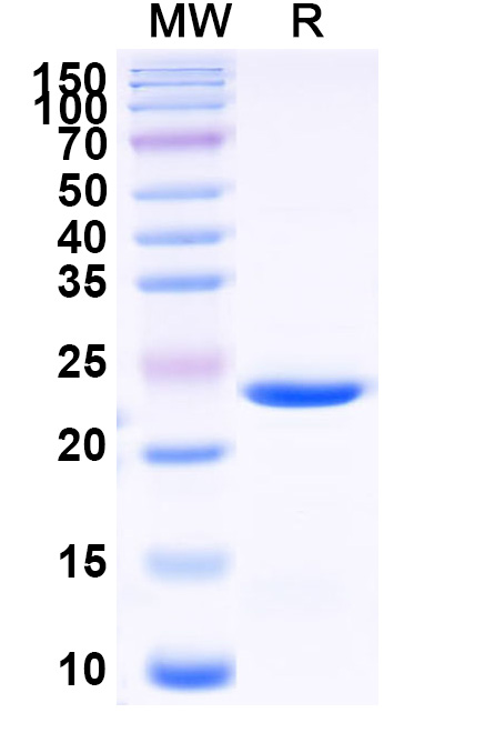 SDS-PAGE for Recombinant Mouse BID Protein, N-His