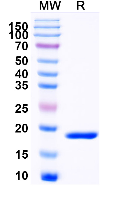 SDS-PAGE for Recombinant Mouse CD339/JAG1 Protein, N-His