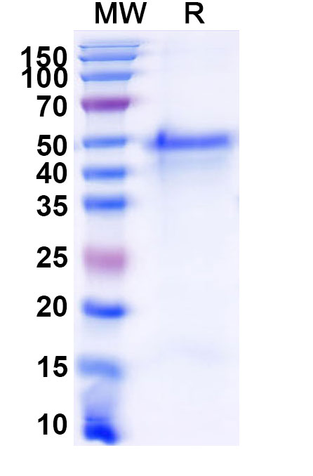 SDS-PAGE for Recombinant Mouse GSDMD/Gasdermin-D Protein, N-His-SUMO