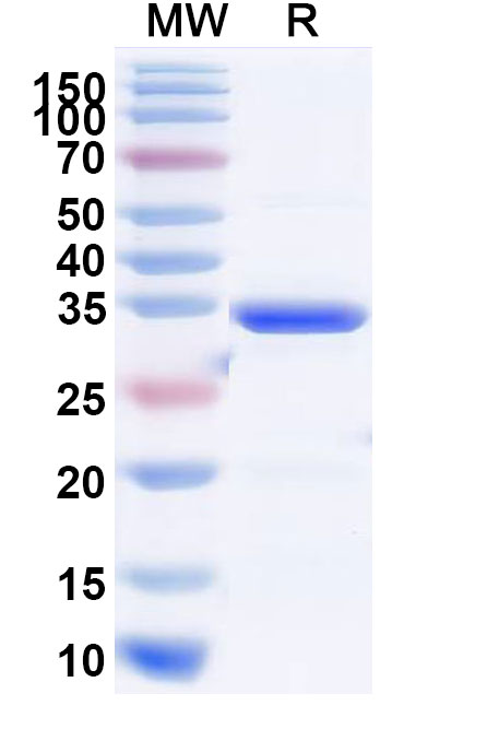 SDS-PAGE for Recombinant Mouse Il11ra1/Etl-2/NR1 Protein, N-His