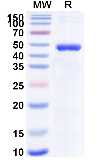 SDS-PAGE for Recombinant Mouse IL4I1 Protein, N-His