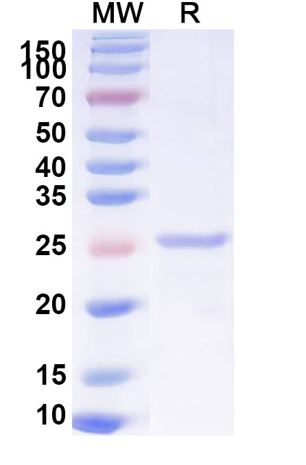 SDS-PAGE for Recombinant Mouse LAMA2 Protein, N-His