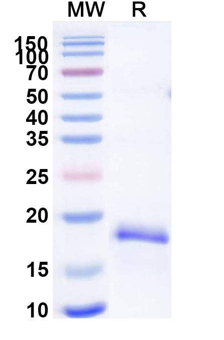 SDS-PAGE for Recombinant Mouse MYDGF Protein, N-His