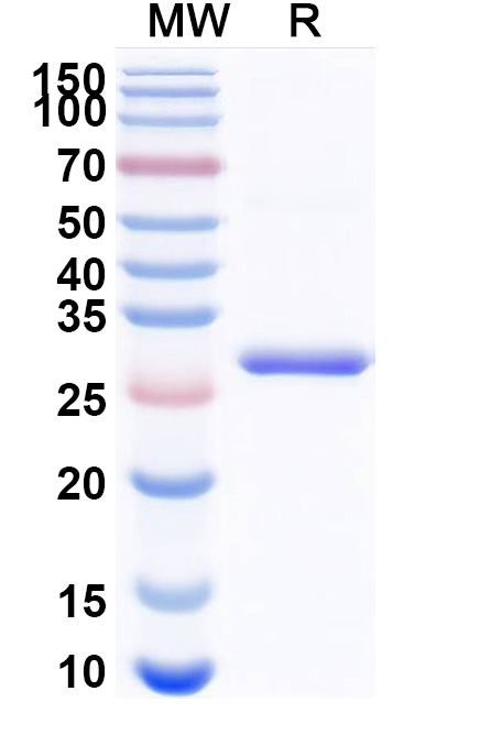 SDS-PAGE for Recombinant Mouse RAGE/AGER Protein, N-His