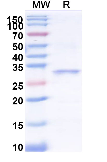 SDS-PAGE for Recombinant Neisseria meningitidis FHbp Protein, C-His