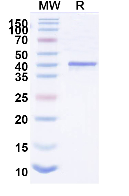 SDS-PAGE for Recombinant Nipah virus/NiV M/Matrix Protein, N-His