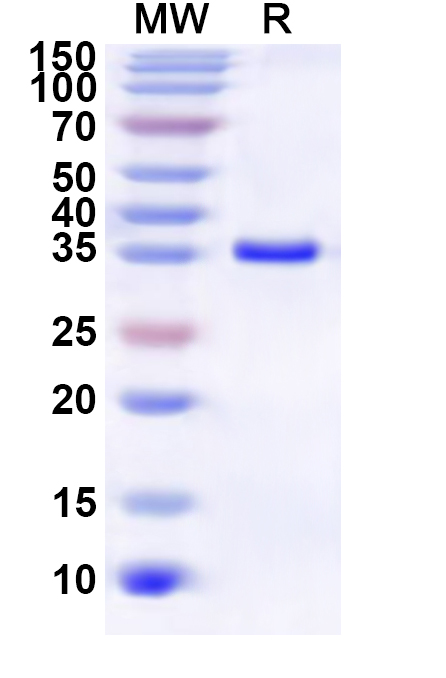 SDS-PAGE for Recombinant PDCoV NS6 Protein, N-GST & C-His