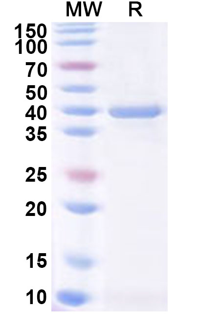 SDS-PAGE for Recombinant PDCoV NSP7 Protein, N-GST & C-His