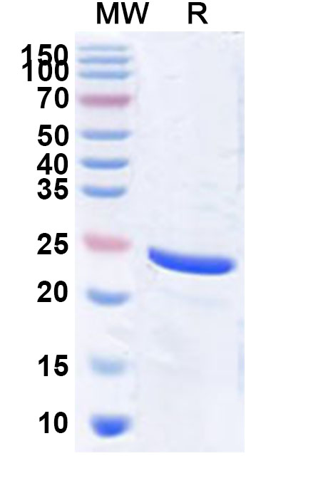 SDS-PAGE for Recombinant PDCoV NSP8 Protein, N-His