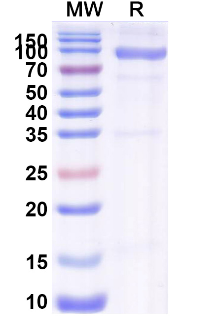 SDS-PAGE for Recombinant PEDV S/Spike glycoprotein Protein, C-His