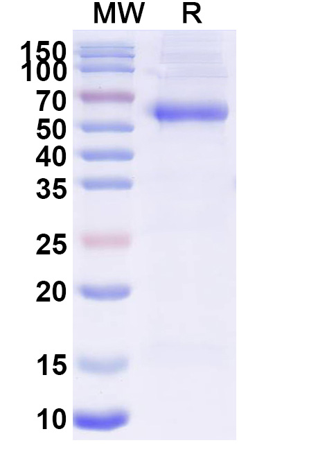 SDS-PAGE for Recombinant PEDV S/Spike glycoprotein Protein, C-His